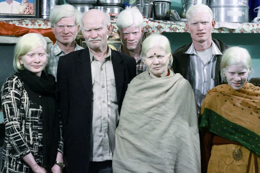 А это самая большая семья альбиносов в мире. 